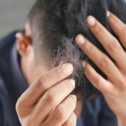 Which Simple Techniques Can You Use To Cover Up The Signs Of Hair Loss Hair Loss