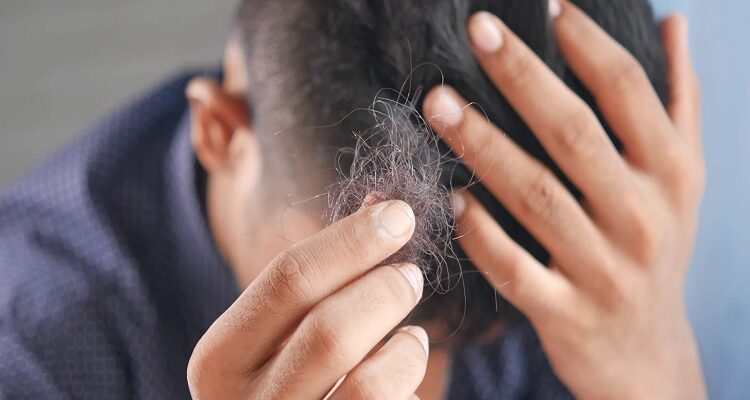 Which Simple Techniques Can You Use To Cover Up The Signs Of Hair Loss Hair Loss